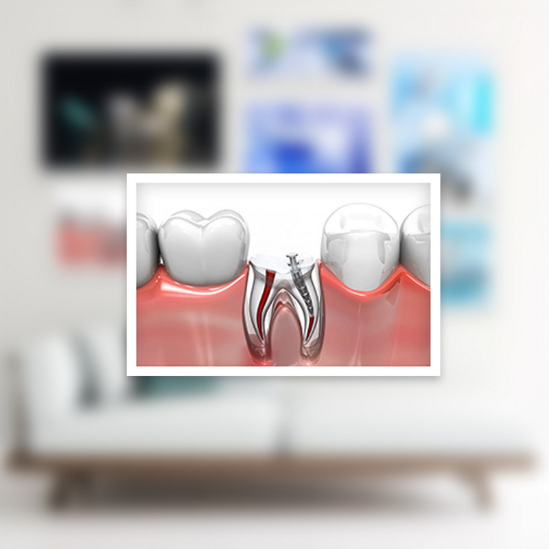 تابلو بکلیت طرح دندان پزشکی و ایمپلنت مدل W-933 مجموعه 7 عددی